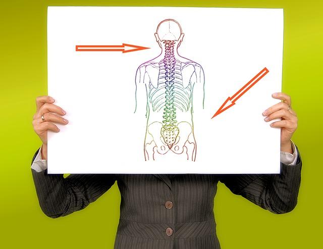 A Herniated Disc